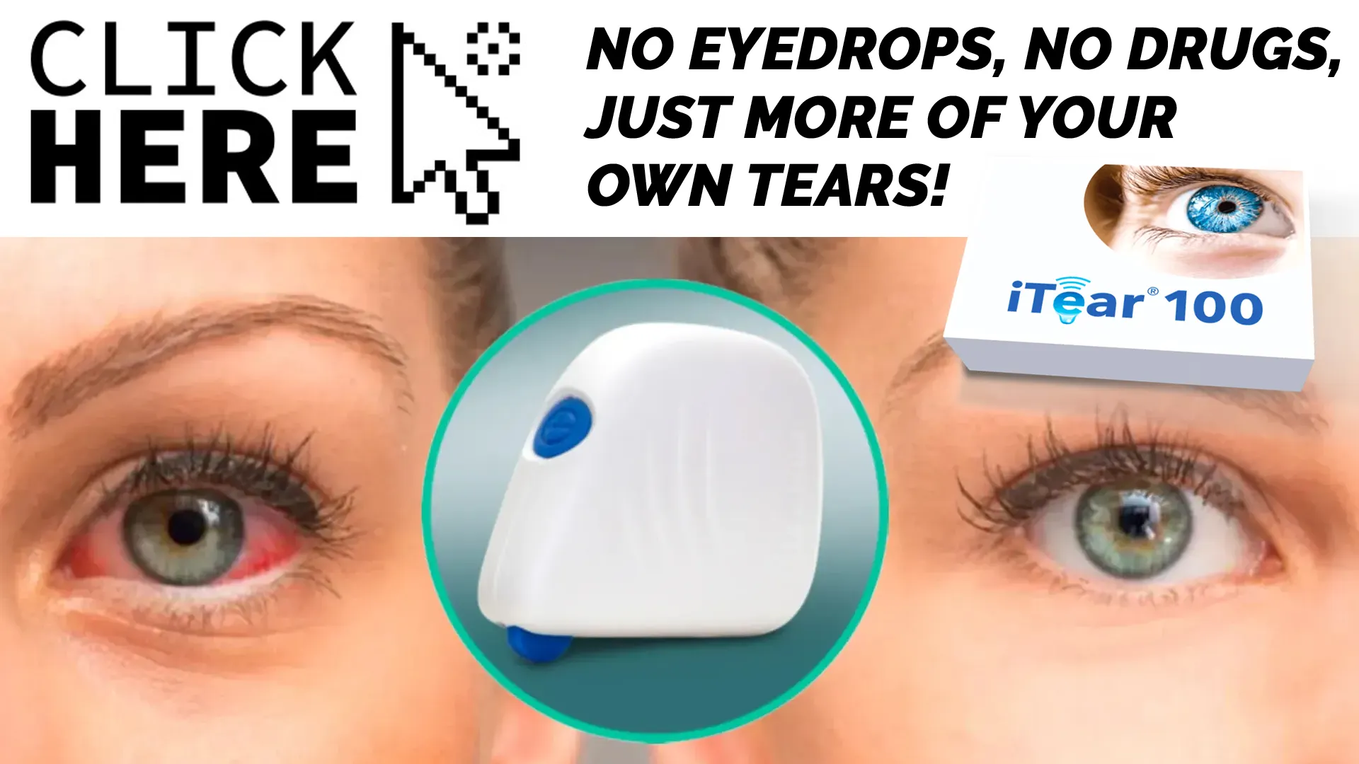 Meet the iTEAR100: A Revolutionary Approach to Managing Dry Eye