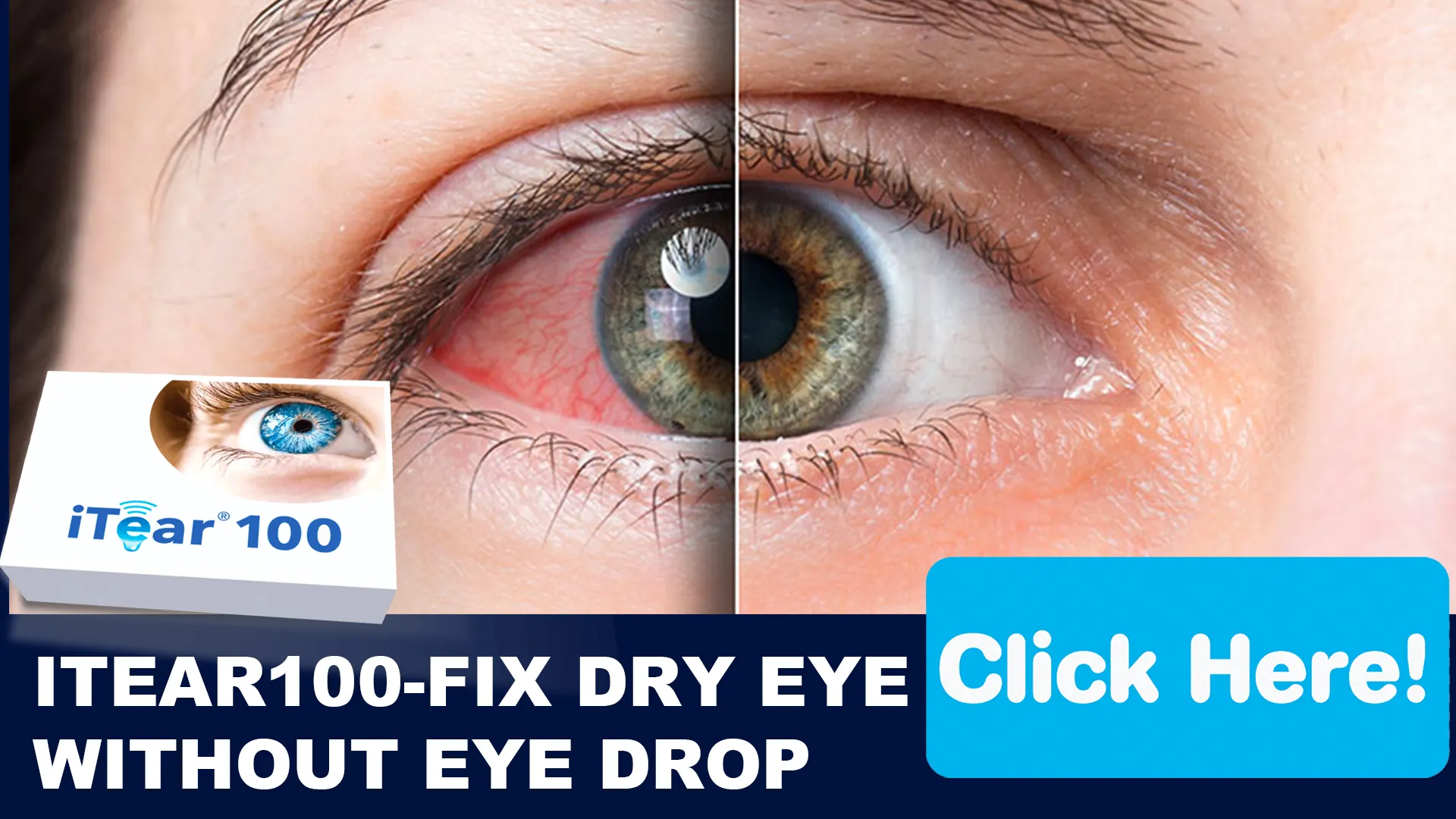 iTear100: Breaking Ground in Eye Care
